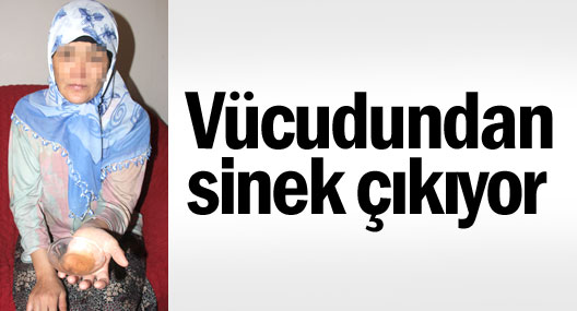 Bu kadının vücudundan sinek çıkıyor!