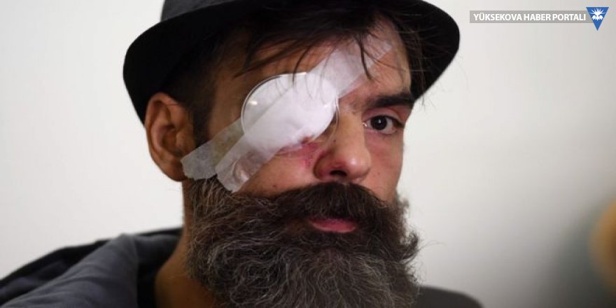 Sarı Yelekliler lideri Jerome Rodrigues 'plastik mermiyle' vuruldu, bir gözünü kaybetti