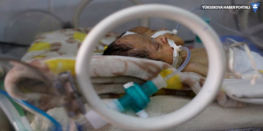 Suudi Arabistan hava sahasını açmadı, iki haftalık yapışık ikiz bebekler öldü