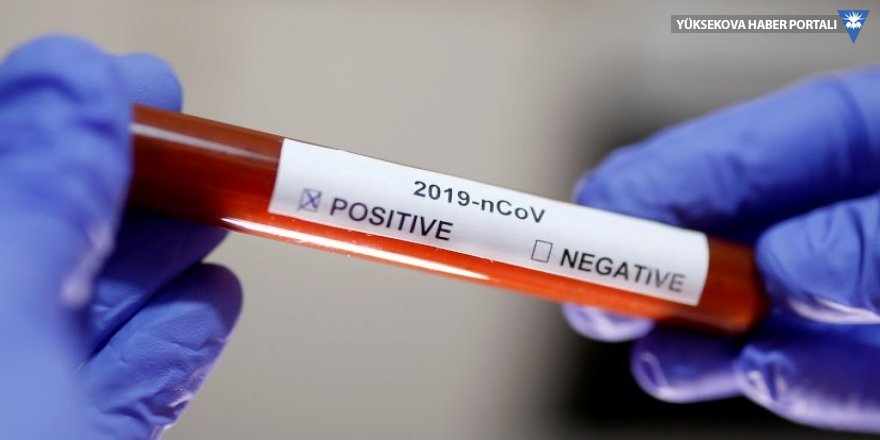 ABD Gıda ve İlaç İdaresi onayladı: Yeni korona virüsü testi 10 kat daha hızlı