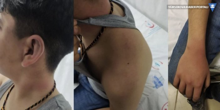 Çocuğa işkenceyle suçlanan iki polis ikinci kez serbest bırakıldı