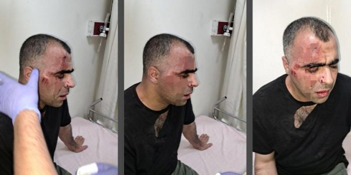 Gazeteci Sinan Aygül: Tatvan belediye başkanının korumalarının saldırısına uğradım