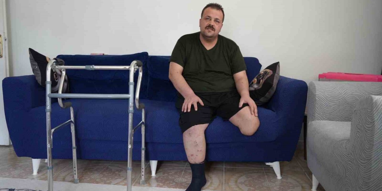 Gaziantep'te tedavi için gitti, ayağı kesildi