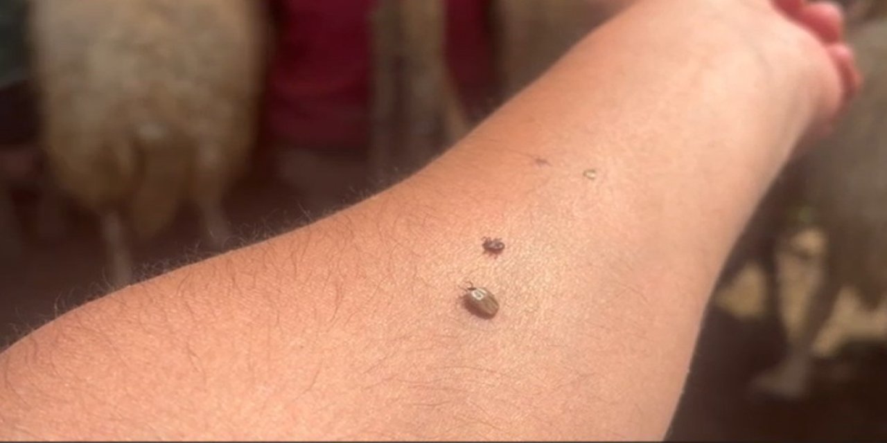 Uzmanından kene uyarısı; Kapalı giysileri tercih edilmeli