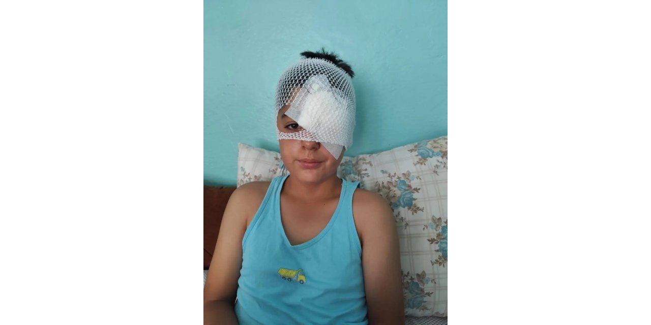 Şanlıurfa’da köpek saldırısından kaçan çocuğa araç çarptı