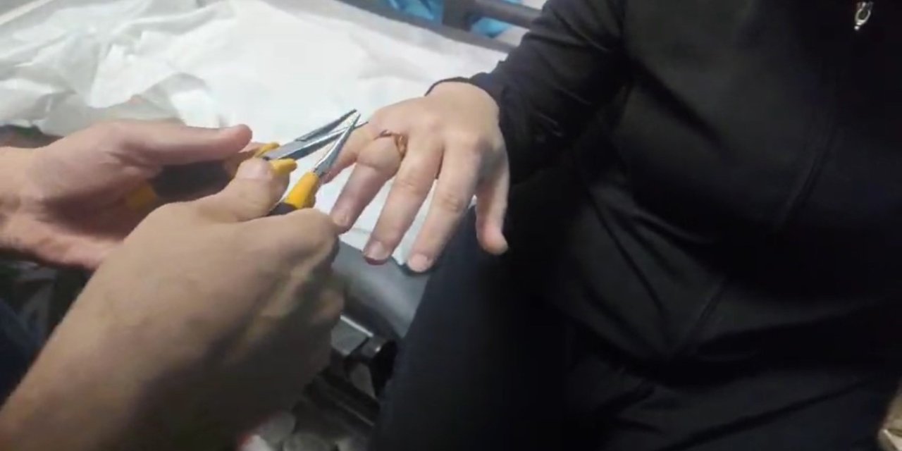 Kadının parmağına sıkışan yüzük, itfaiye ekibince  çıkarıldı