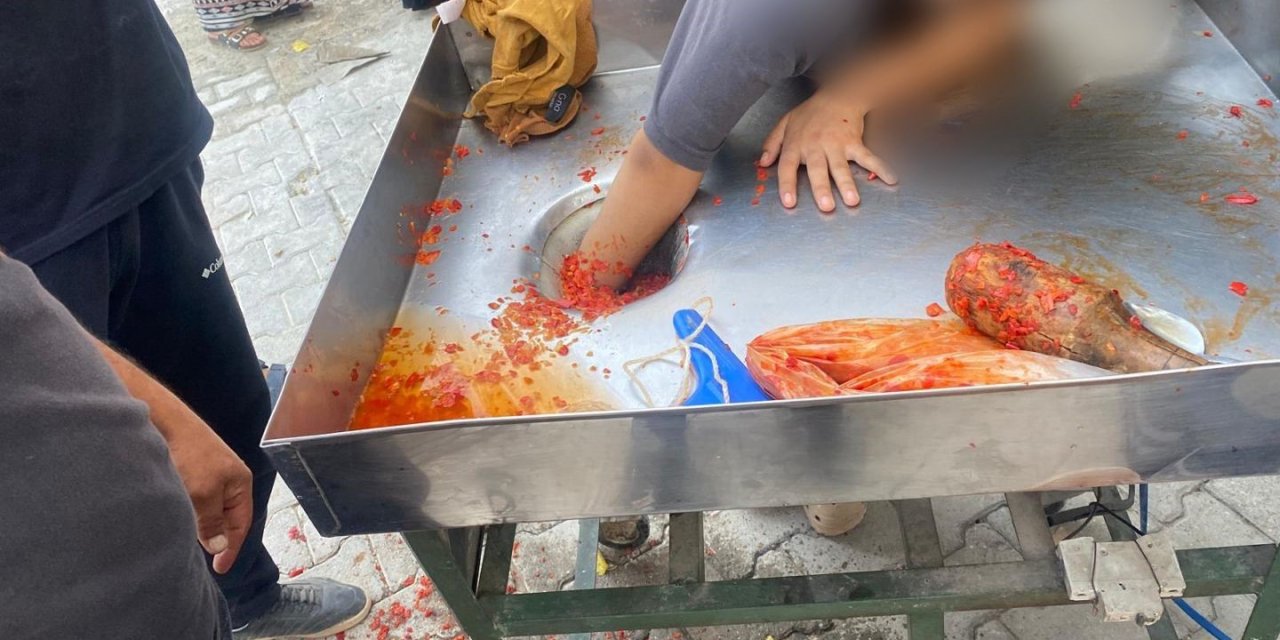 Şanlıurfa'da kız çocuğu elini salça makinesine kaptırdı