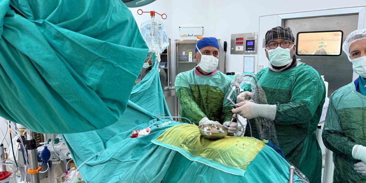8 santimetrelik ’geyik boynuzu’ böbrek taşı kapalı yöntemle çıkarıldı