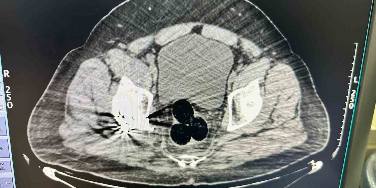Iğdır’da "uyuşturucu" operasyonu