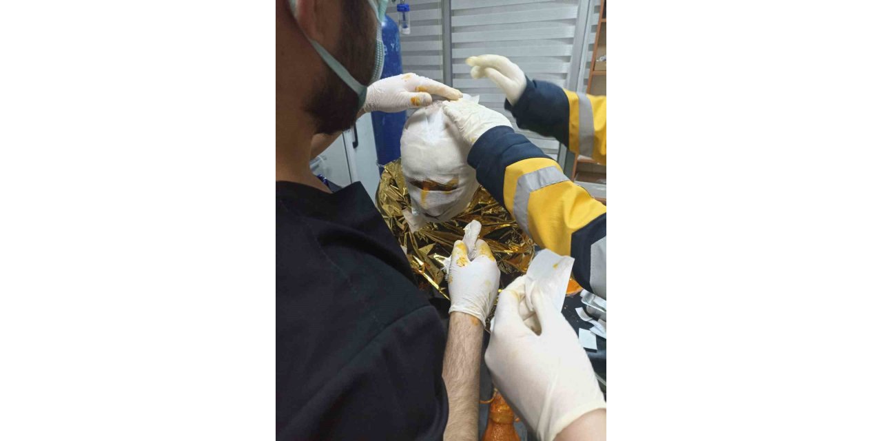 Erzincan’da kömür ocağında yangın: 2 kişi yaralı