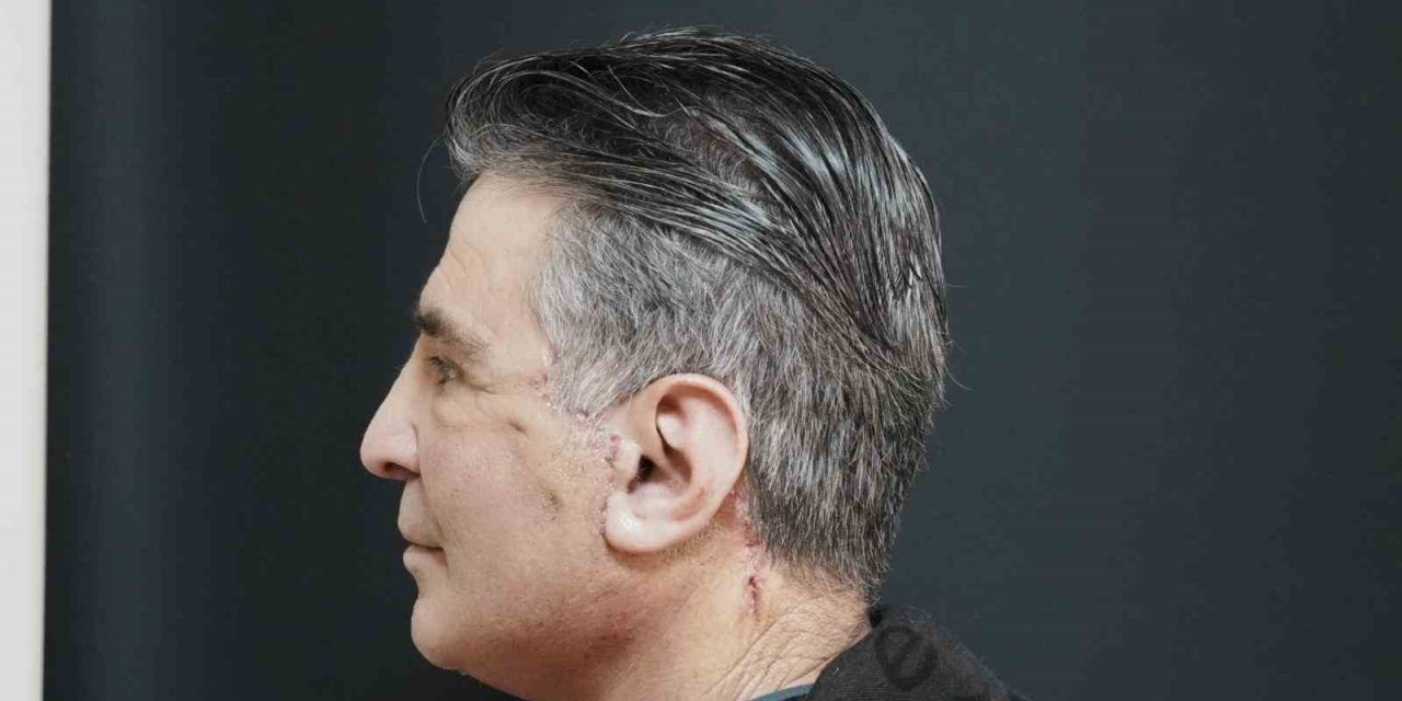 Bitlis’te ilk defa yüz germe ameliyatı yapıldı