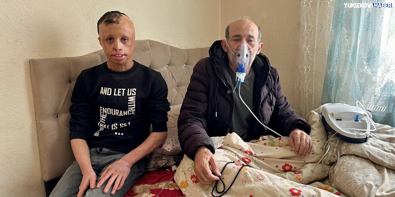 Yangında yaralanan Demhat İliş, yüz nakli için destek bekliyor