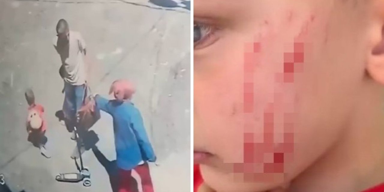 Van’da sokakta oynayan çocuğa saldırı