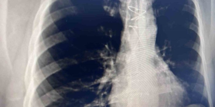 Tütün ürünleri uyarısı: "Elektronik sigara zararsız değil"