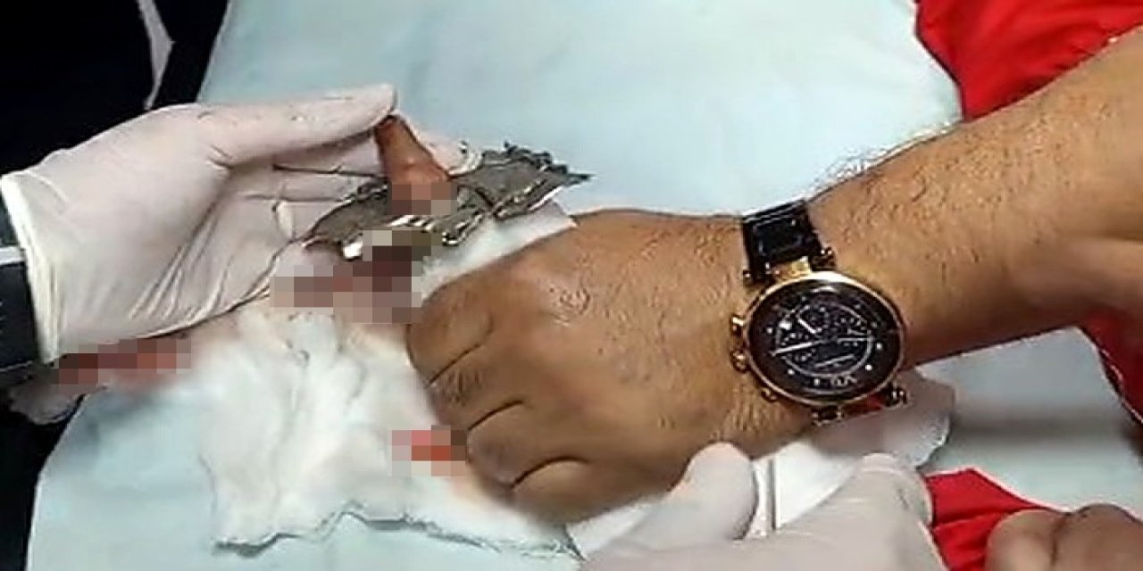 Bitlis’te parmağı çelik halkaya sıkışan çocuk kurtarıldı