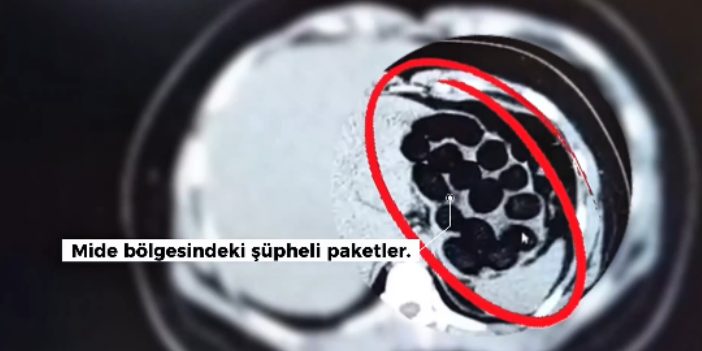 Yüksekova’da yutma yöntemiyle uyuşturucu taşıyan 2 kişi yakalandı