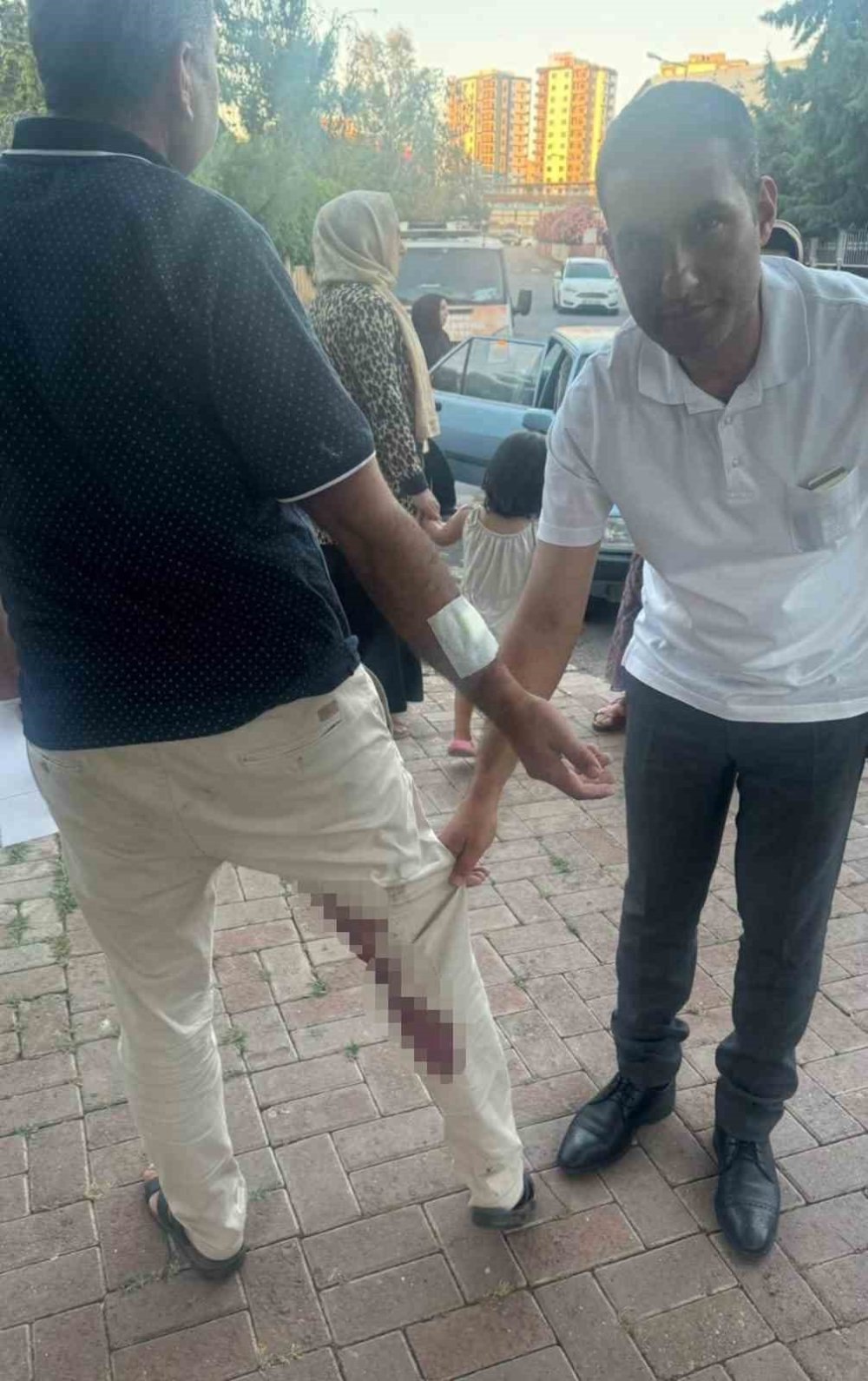 Kuduz çıkan köpek Şanlıurfa'da bir vatandaşı ısırdı