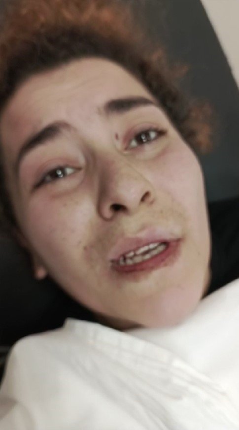 Antep’te parkta baygın bulunan genç kadın, hastanede öldü