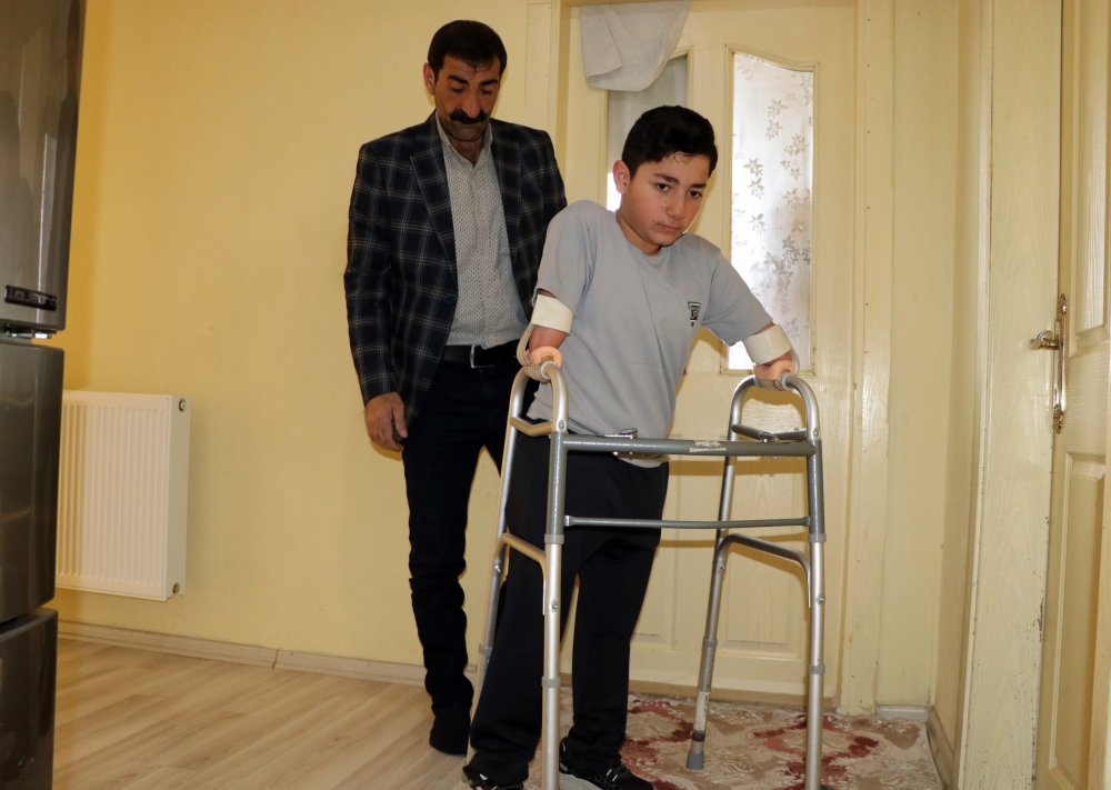 Nakşin'in yeni protez mutluluğu