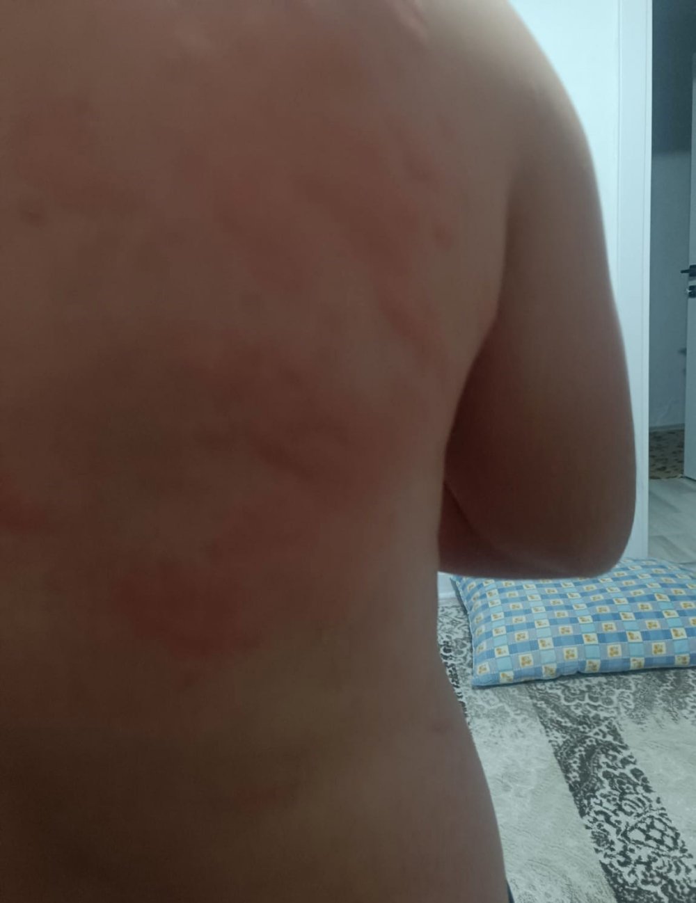 Karakoçan'da böcek ısırığı hastanelik etti