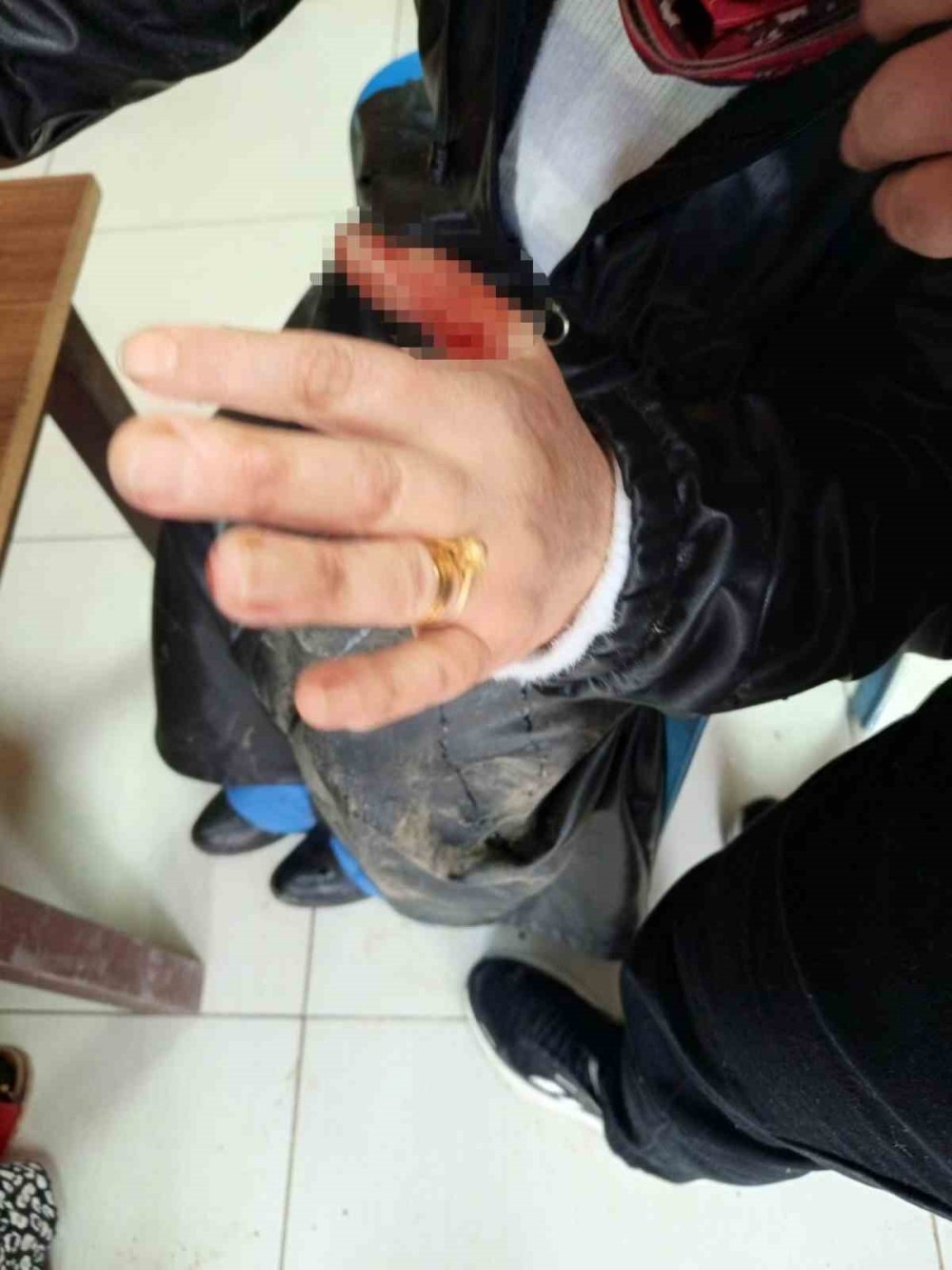 Diyarbakır’da başıboş sokak köpeği dehşeti