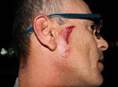 Özel harekat polisleri gazetecilere saldırdı
